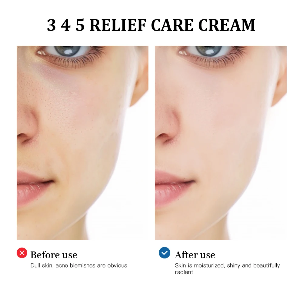 Enhanced Relief Cream - Antioxidant Formula for Nourished, Blemish-Free Skin, Long-Lasting Moisture