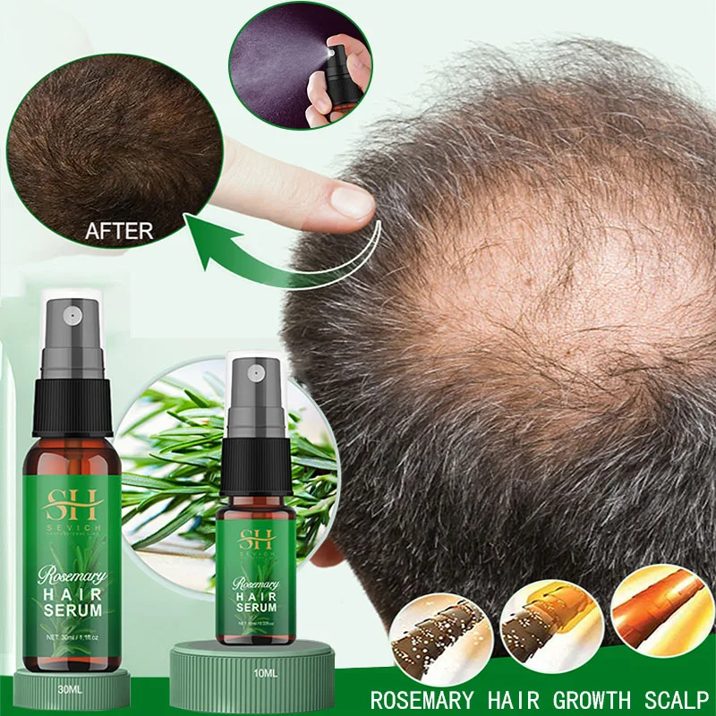 

Rosemary Hair Growth Products 30ml Fast Growing Hair Essence Oil Prevent Hair Loss Spray Scalp Treatment For Men Women Hair Care