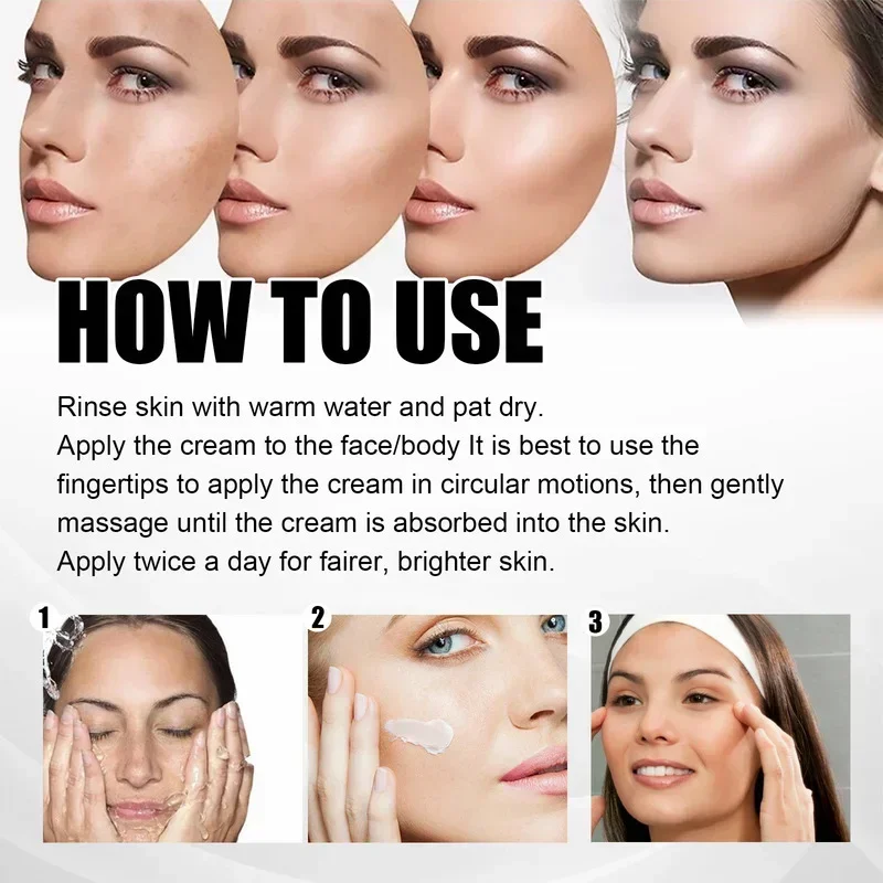 Face Cream Remove Melasma Dark Spots Lighten Melanin Remover Moisturizing Brightening Face Smooth Skin Korean Care Product 30ML