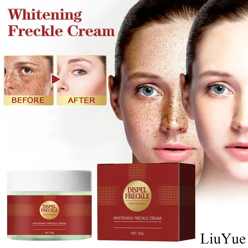 Remove Spots Niacinamide Cream Skin Whitening Lightening Chloasma Freckles Serum Women Face Fast Reduces Melasma Brighten Cream