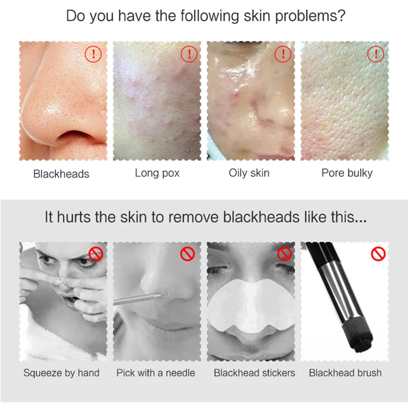 Blackhead Vacuum Cleaner Pore Ance Black Dots Extractor Vacuum Suction Tool Exfoliating Cleansing Comedo Suction Pore Cleaner