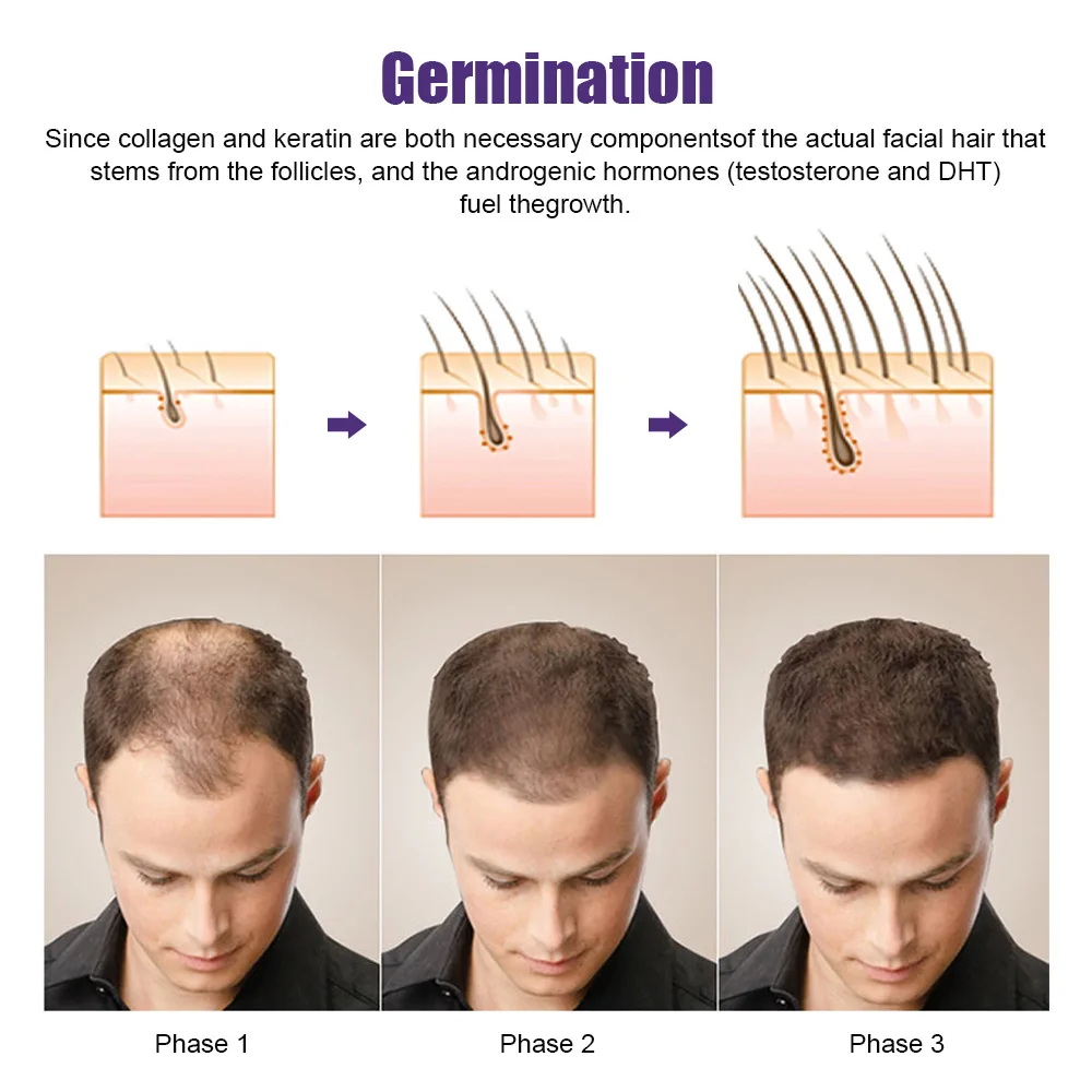 Derma Roller Microneedling Derma Pen Derma Stamp Derma Microneedling Microneedle Micro Needles Face Roller for Hair Growth Dermastamp Skin Care Mesotherapy Beauty