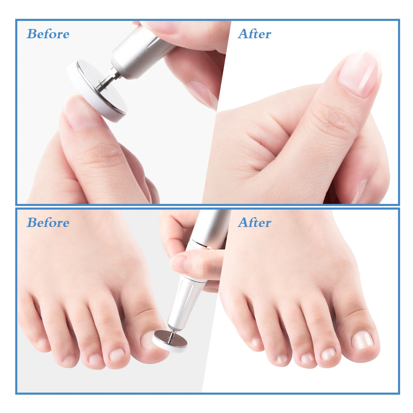 foot sanding paper self-adhesive replaceable for professional pedicure polishing remove dead skin calluse buffing disc
