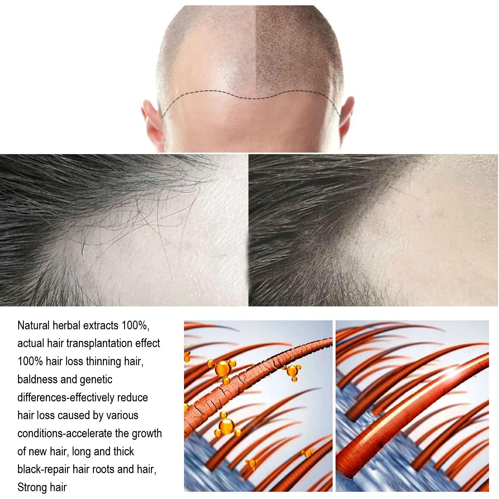Essência do Condicionador do Gengibre do Soro do Crescimento do Anti-cabelo Fortalece o Cabelo Impede o Cabelo Óleo do Cabelo da Máscara do Reparo dos Danos da Raiz Quebrado 6 do crescimento do anti-cabelo fortalece o cabelo,