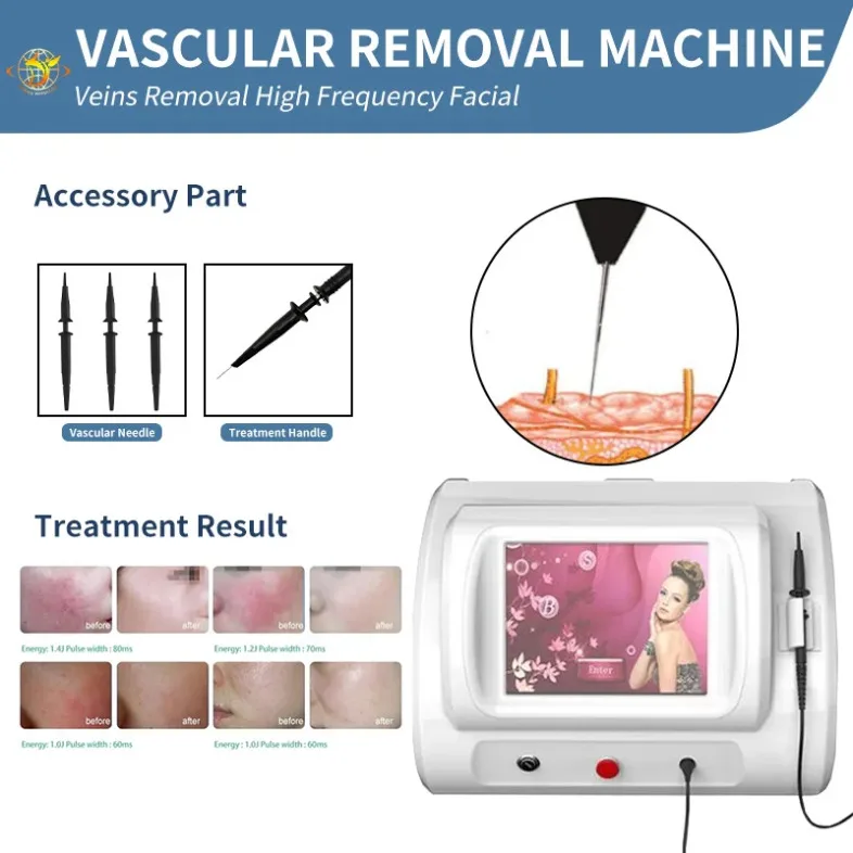

High Frequency R-F Vein Removal Vascular Facial Spider Veins Red Blood Beauty Equipment