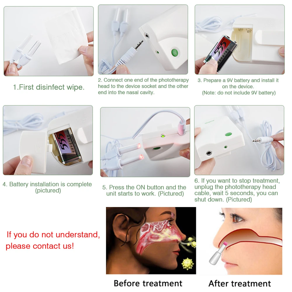 Nose Treatment Device Proxy BioNase Therapy Machine Rhinitis Sinusitis Cure