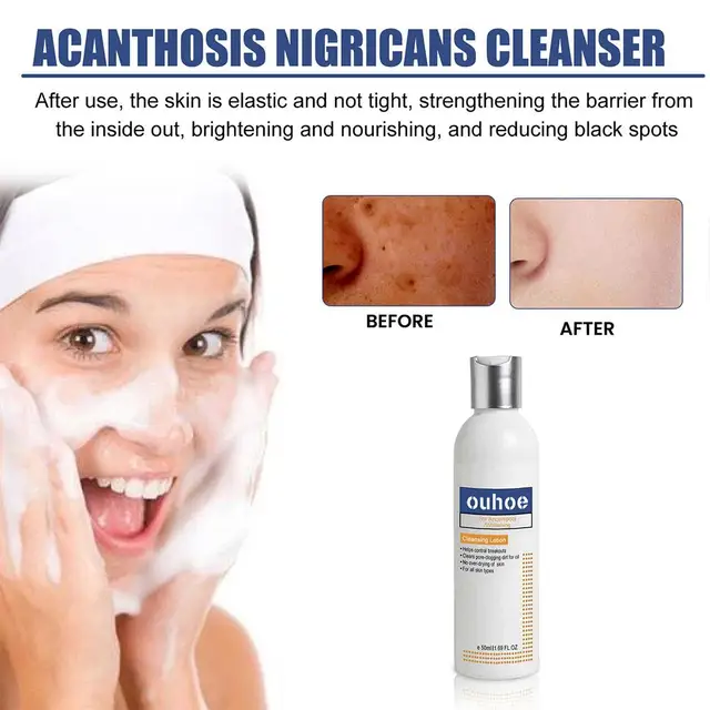 Whitening Facial Cleanser Brighten Skin Tone Refreshing, 49% OFF