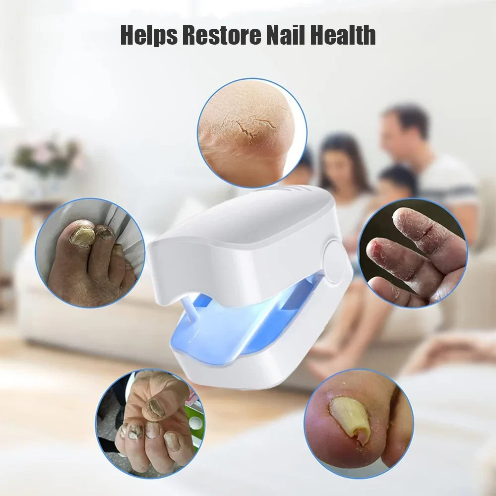 Home Use Nail Fungus Cleaning Laser Device Treatment Repair Toenail Fingernail Fungus Onychomycosis Remover Cure Therapy Machine