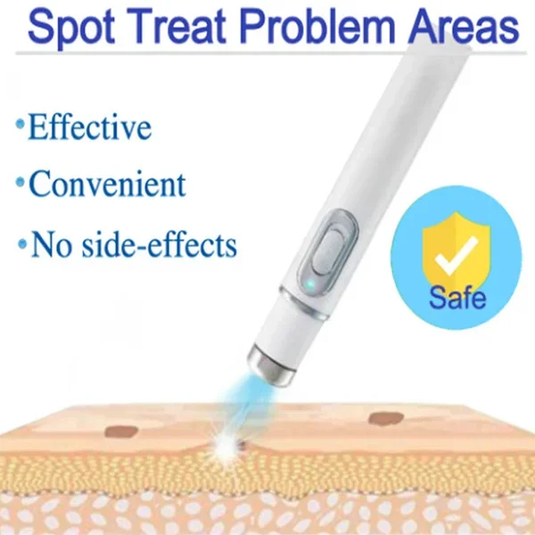 Laser Repair Skin Scars 1-7pcs Powerful Scar Removal Cream Fast Remove Deep Skin Scar Blue Light Therapy Pen Recovery Cream