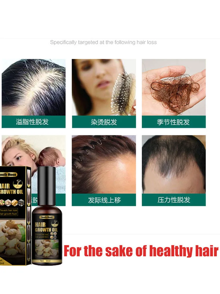 

For Alopecia.Anti hair loss spray anti hair loss hair nutrition growth agent essence promotes hair growth.