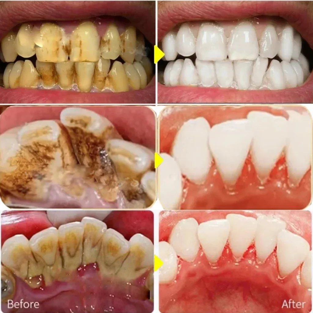 Dental Calculus Remover Teeth Whitening Spray Toothpaste Cleaning Oral Hygiene Removal Halitosis Plaque Stains Fresh Breath Care teeth whitening product,dental calculus remover,teeth health product