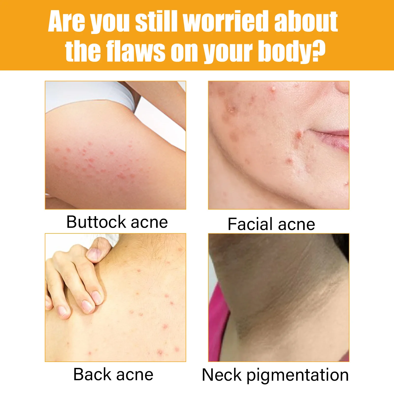 Рисунок 3 - Сыворотка для лечения акне для тела