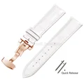 White-Rosegold