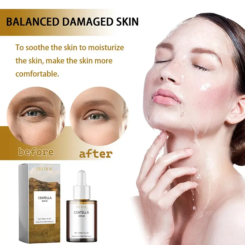 Centella Asiatica Face Serum Nourish Dry Skin Smoothing Rejuvenation Skin Brightening Whitening Cream Facial Moisturizer Korean - Image 4