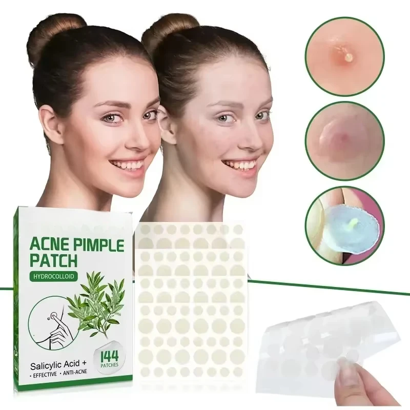 144pcs Acne Pimple Patch Face Invisible Stickers Quick Effect Treatment Removing Patches Beauty Acne Tools Face Skin Care