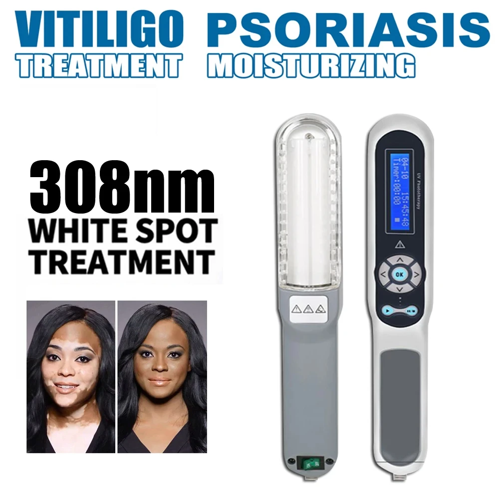 308nm Handheld uvb Light Therapy Portable Effective To Treat vitiligo Psoriasis Eczema Uvb Lamps Uv Phototherapy Instrinstrument 2