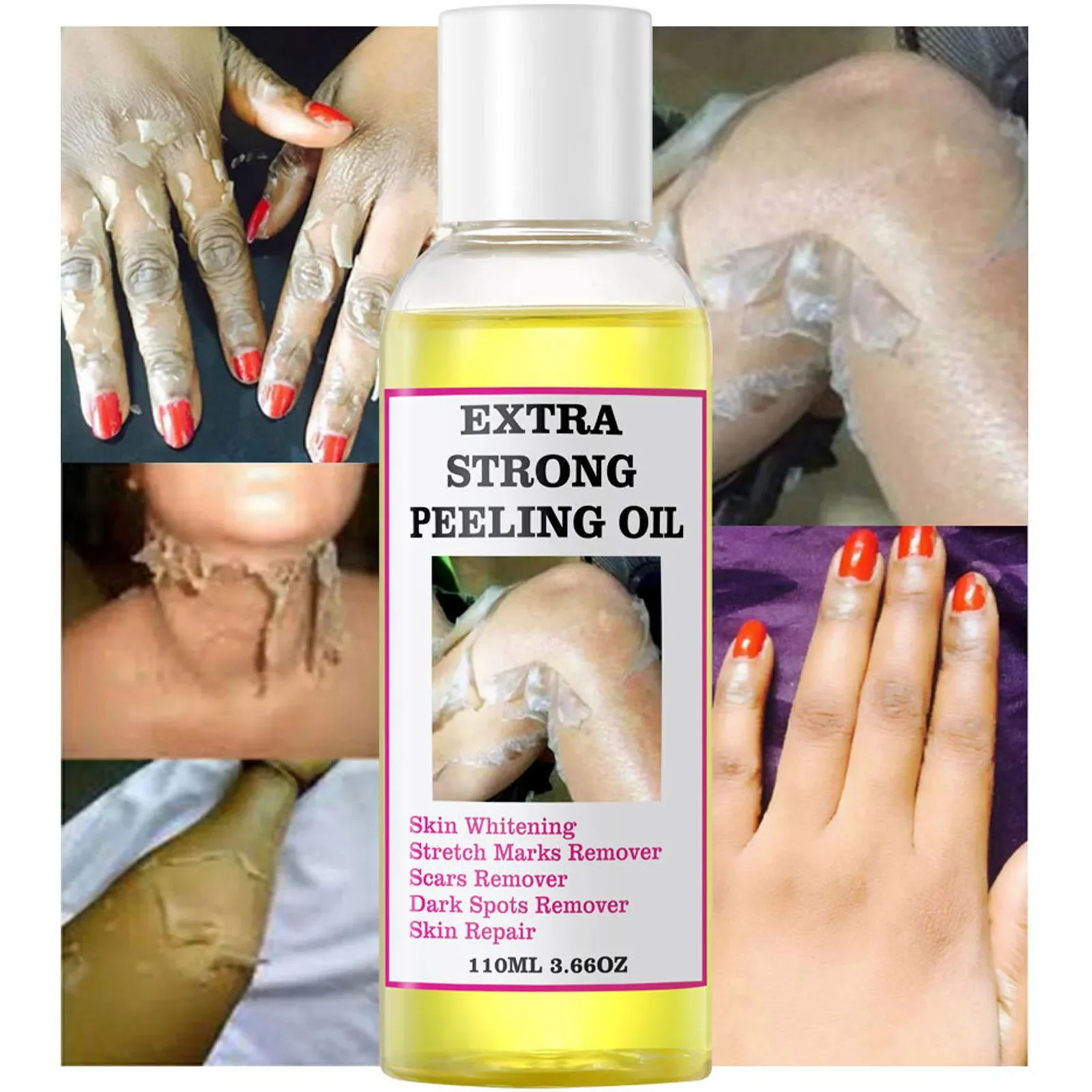 

Peeling Oil For Dark Skin Super Strength Yellow Peeling Oil Strong Peeling Oil For Unisex And All Skin Types Full Body Available