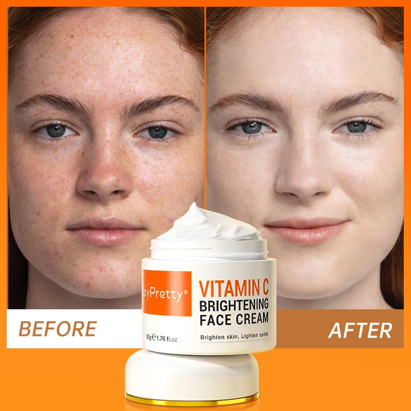 VitaminCWhiteningFaceCreamDarkSpotsRemoverFreckleBrightening