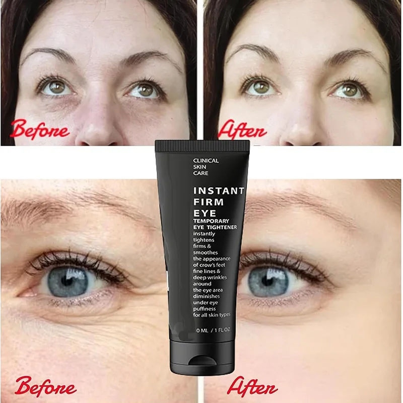 

Instant Firm Eye Cream Reduce Fine Lines and Dark Circles Around the Eyes Lifting the Skin Remove Eye Bags Eye Tightener 30ml