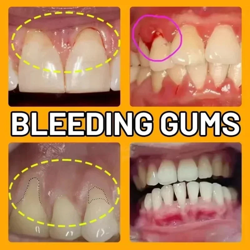 Rapid Repair Gums Serum Relieve Tooth Allergy Dental Caries Tooth Cleaning Toothpaste Relieve Damage Drops gum repair drops,teeth health product