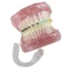 Dental Orthodontic Typodont Teeth Model With Self-Ligating Metal Ceramic Bracket Lingual Hawley Retainer Ligature Standard Demo 6