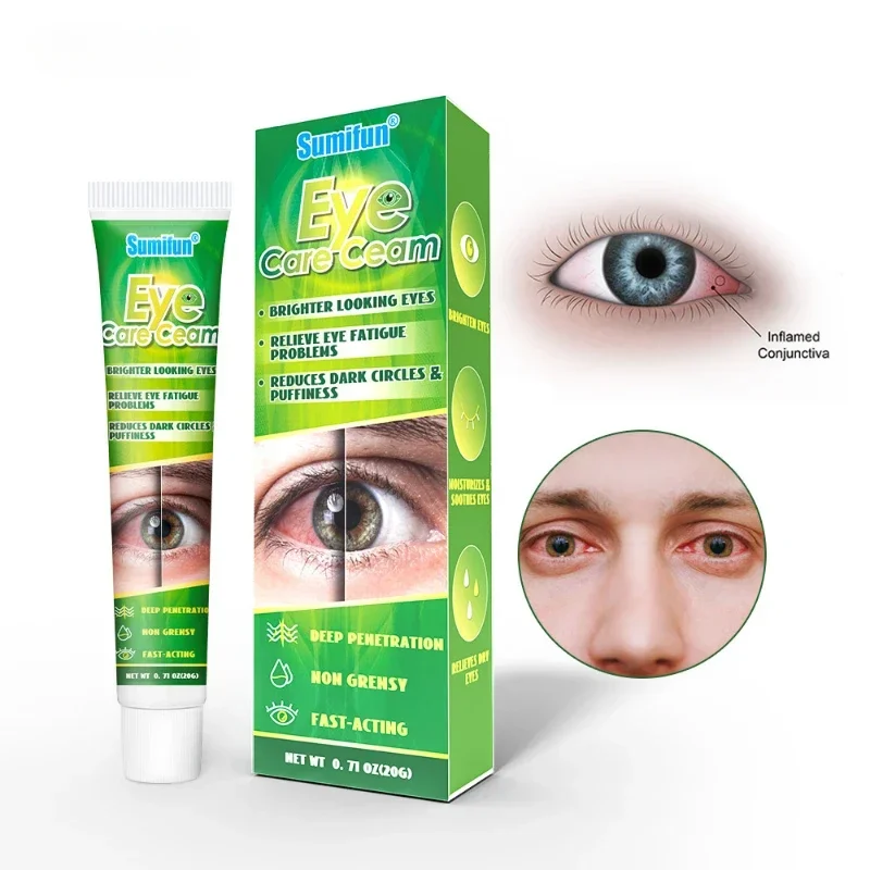 Eye Care Cream Remove Eyes Red Blood Clear Dry Fatigue Ointment Enhance Vision Herbal Medical Plaster Prevent Myopia eye cream