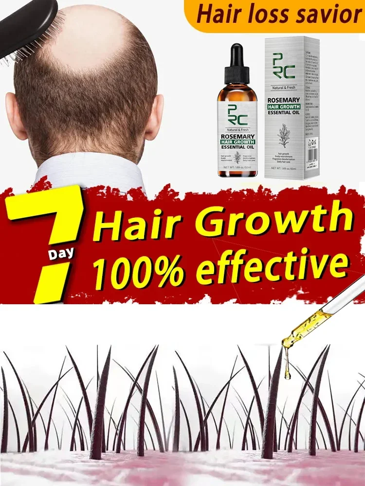 

Rosemary Oil Hair Growth for Men Women Fast Growing Products Essential Oils Ginger Anti Hair Loss Scalp Treatment Hair Care