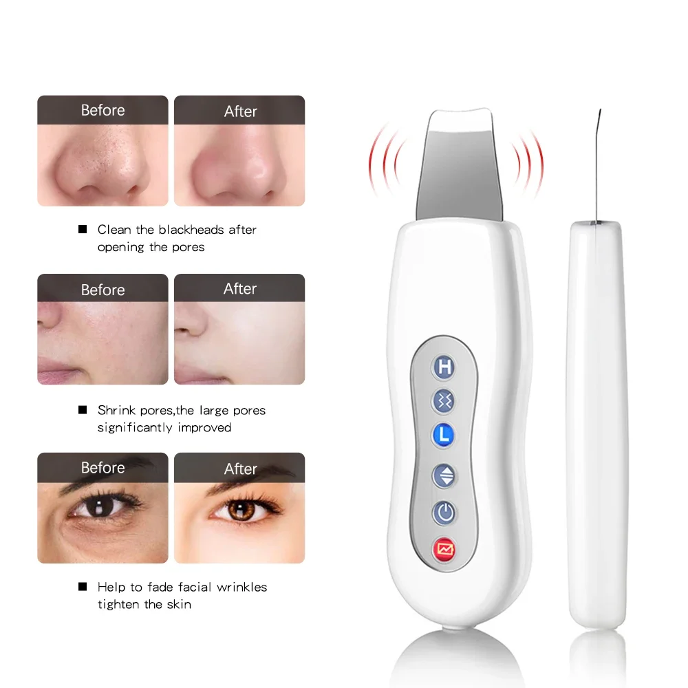 Ultrasonic Skin Scrubber Cleaning Face Cleanser Acne Remover Facial Lifting Massager Ultrasound Skin Care Peeling Clean Machine