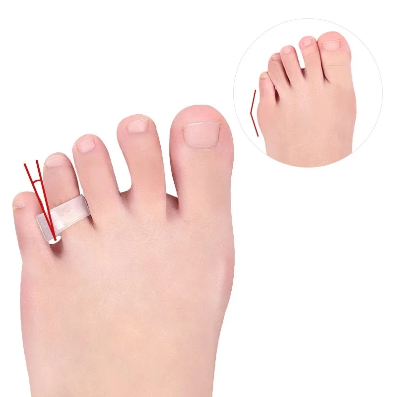 

10Pairs Hammer Toe Gel Hallux Valgus Orthosis Separators Splitter Bunion Corrector Pain Relief Silicone Foot Care Tools Pedicure