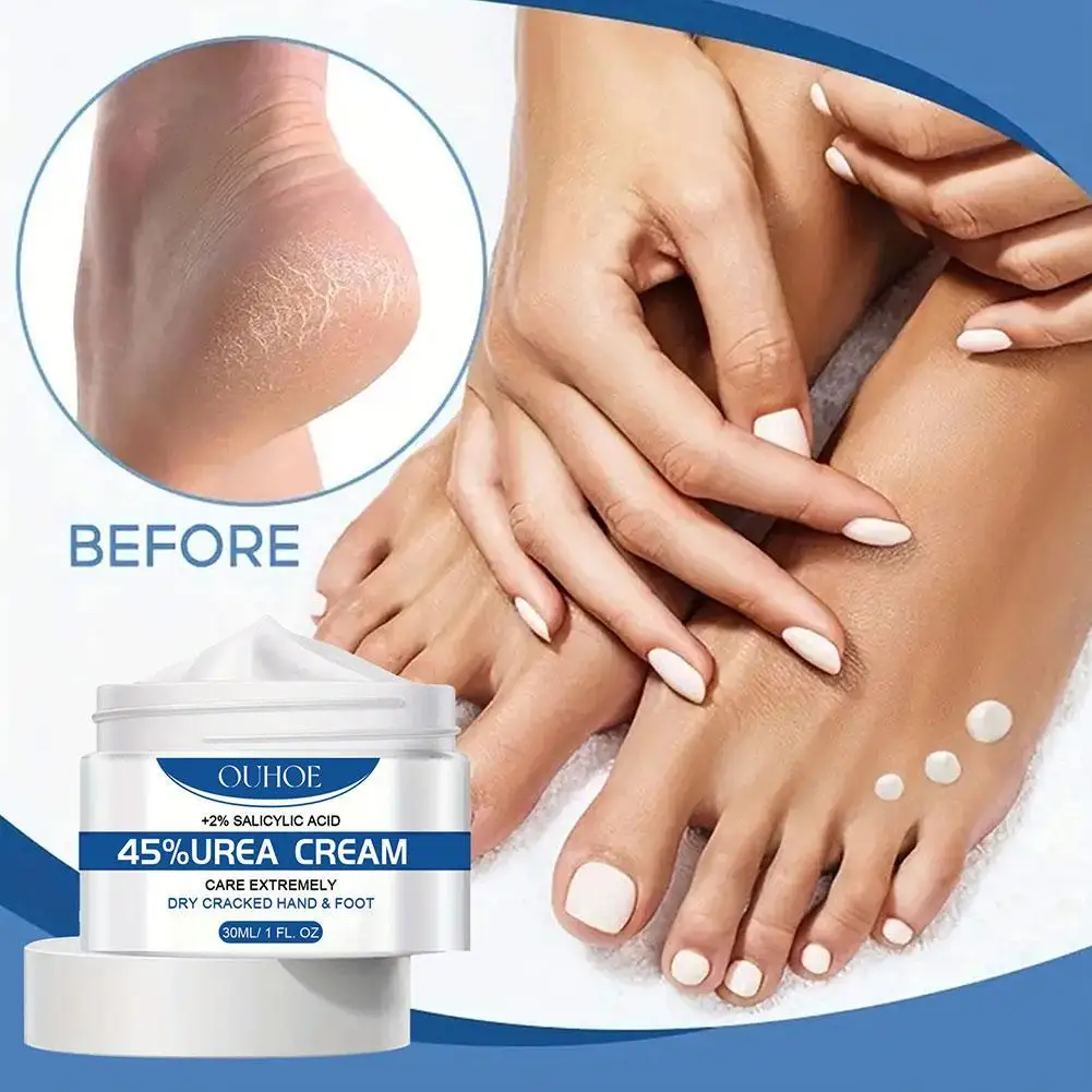 

Cracked Heel Balm Cream For Rough Dry Cracked Chapped Hand/Feet Heel Skin Care Cream Natural Essence Skin Care For Body