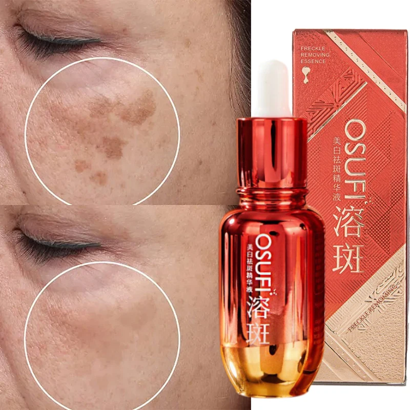 Whitening Freckle Removing Facial Serum Brightening Removing Black Spots Reducing Pigmentation Correcting Facial Skin Care 50ml dark spot corrector serum lightening pigmentation melasma melanin freckle remover whitening glow skin brightening face essence