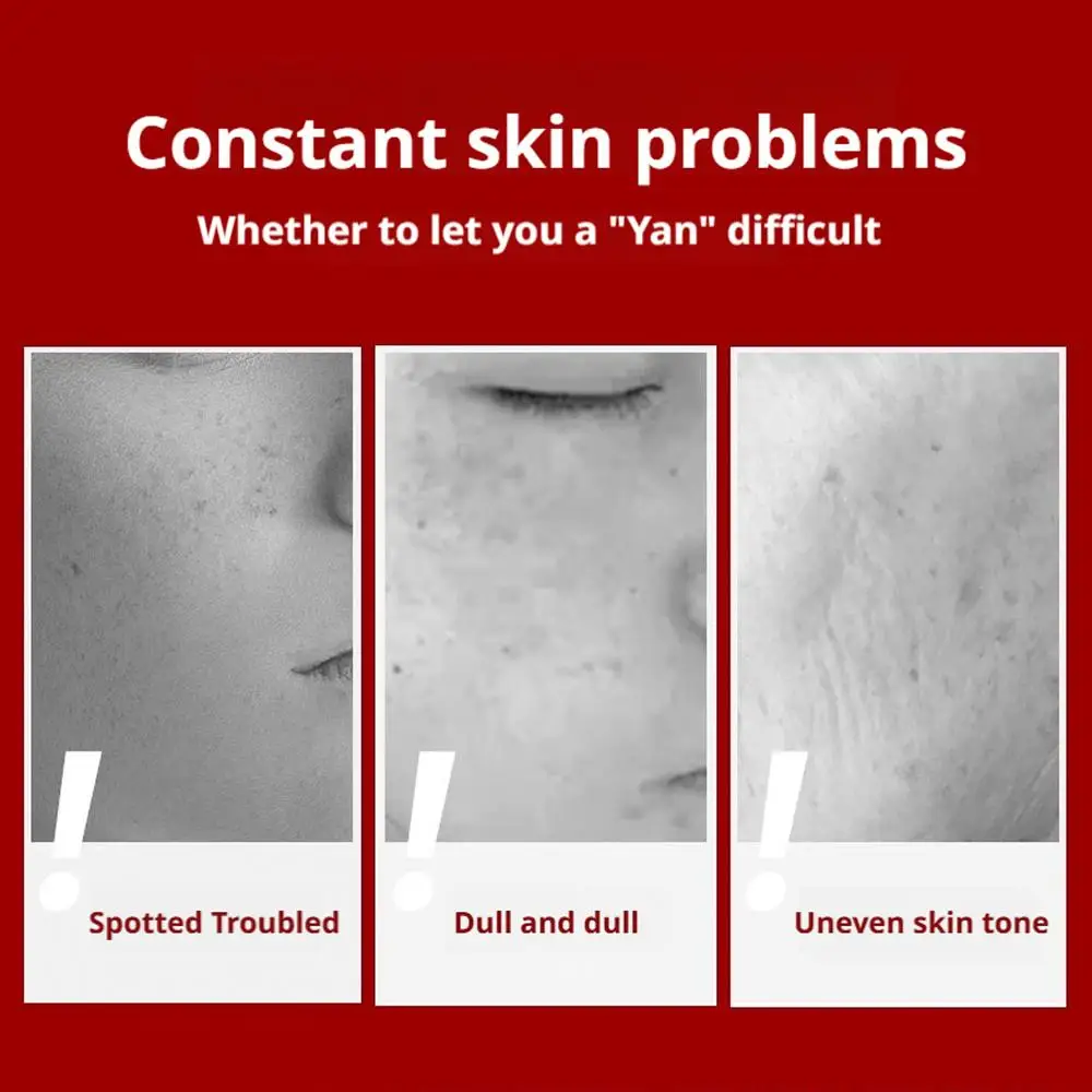 كريم تبييض كوري للعناية بالبشرة وإزالة البقع، يتلا...