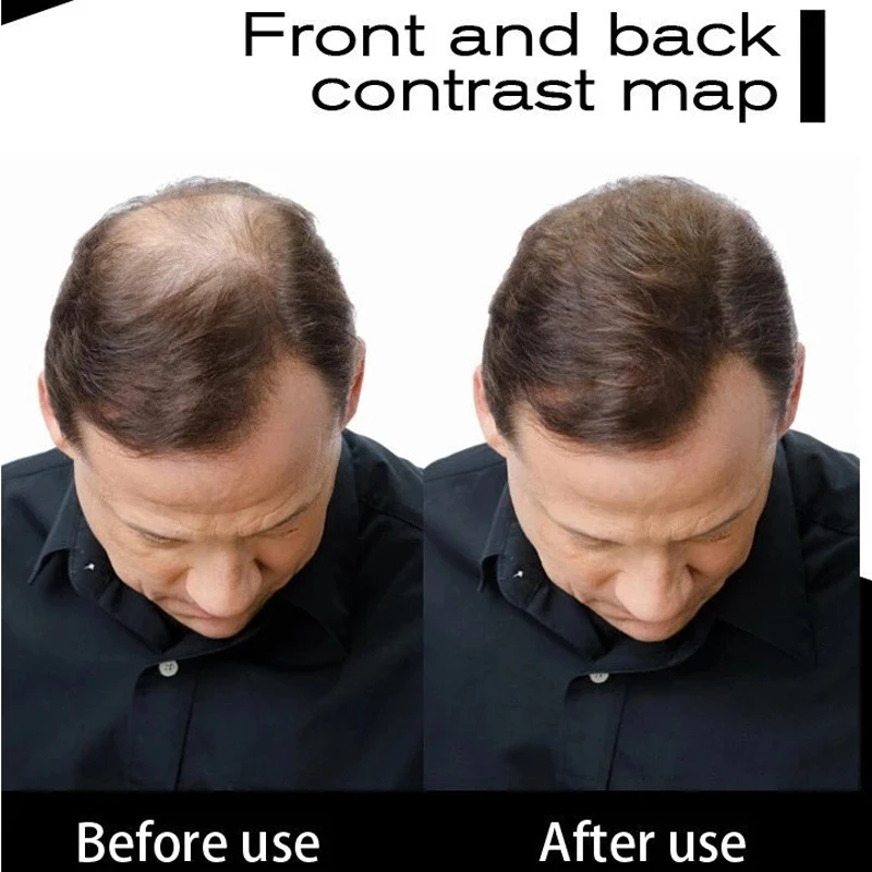 Stem Cell Dense Hair Fibers Keratin Activated Thickening Hair Building Fibers Regeneration Treatment Growth Essence hair building fibers