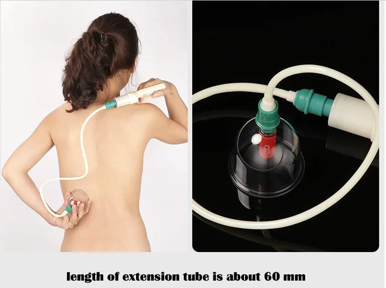 Vacuum Cupping Massage Cans Body Massager Cellulite Massager Health Monitors Products Cans Massage Cupping