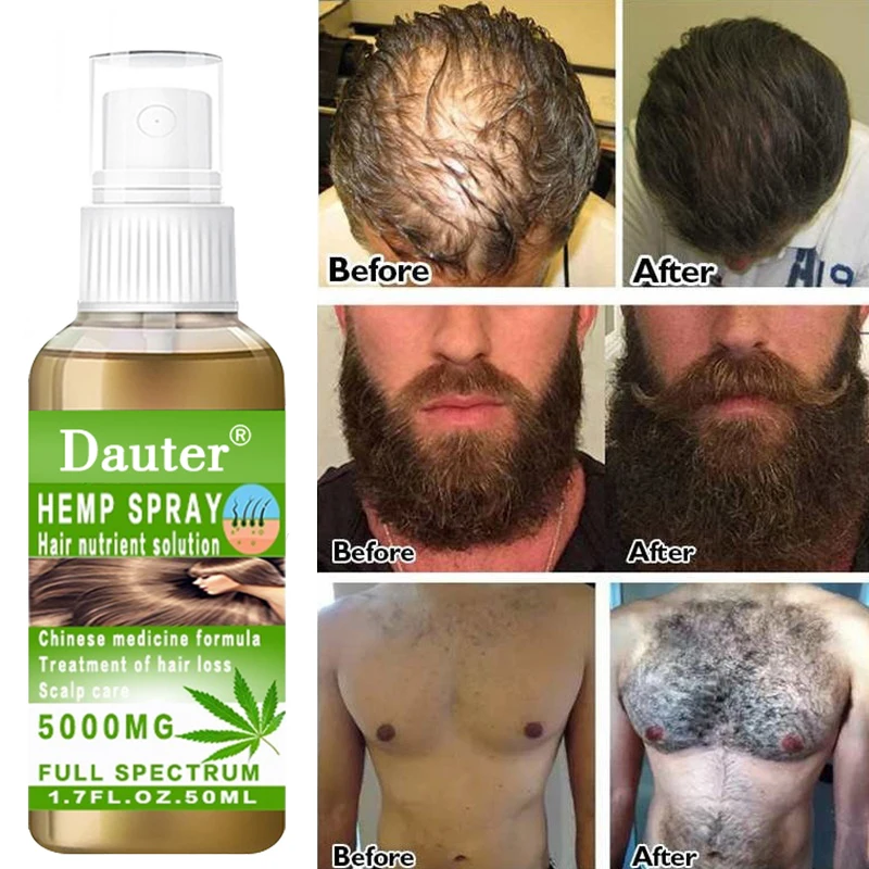 Herbal hair growth spray scalp care rapid hair growth repair damaged