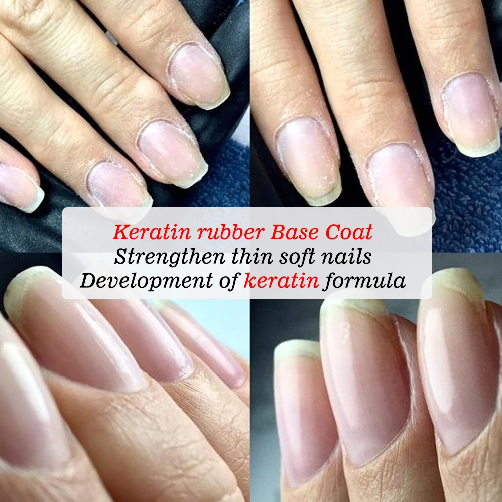 KODIES GEL Keratin Rubber Base Coat 15ML Nail Strengthener Gel Nail Polish Semi permanent UV Durable Base Varnish Protects Nails 6