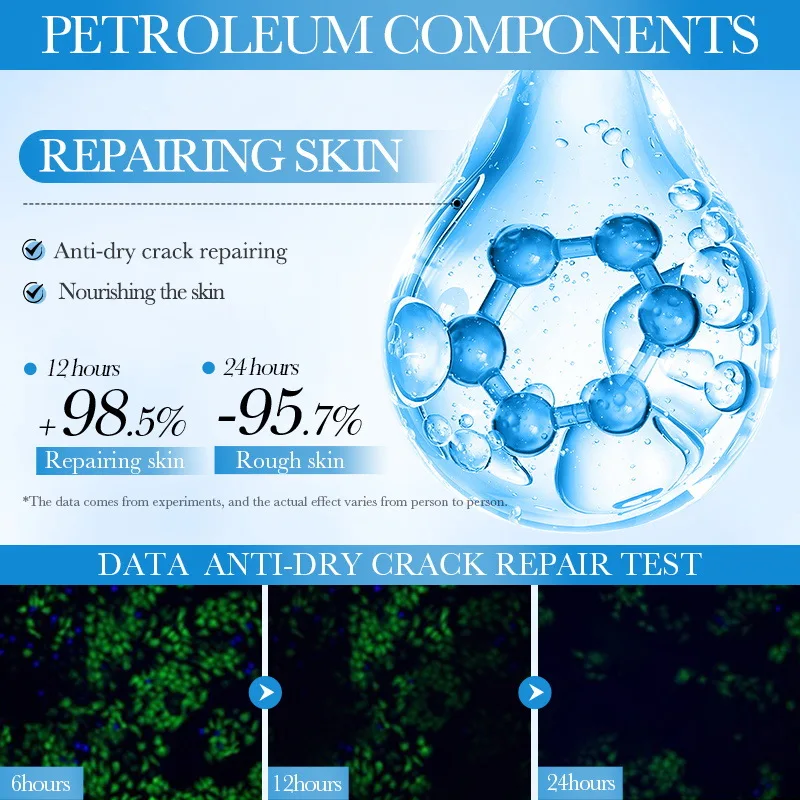 Hands and Feet Chapping Gel Heel Hydrating Repair Gel Autumn and Winter Moisturizing Protective Hand and Foot Care Cream