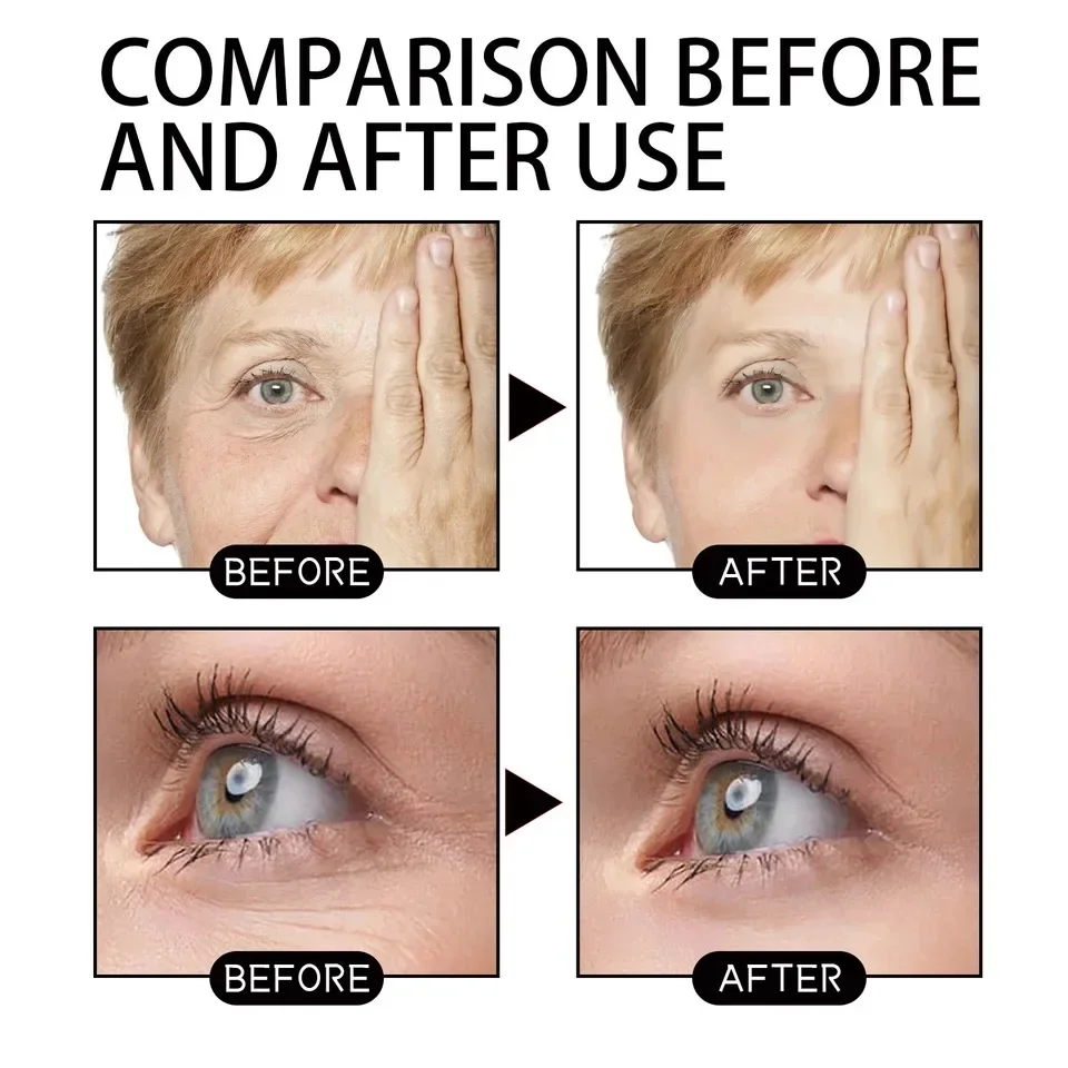 Fast Wrinkle Remover Face Serum Lifting Firming Fade Fine Lines Anti-aging Essence Nouris Skin Care Quickly 6