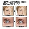 Fast Wrinkle Remover Face Serum Lifting Firming Fade Fine Lines Anti-aging Essence Nouris Skin Care Quickly 6