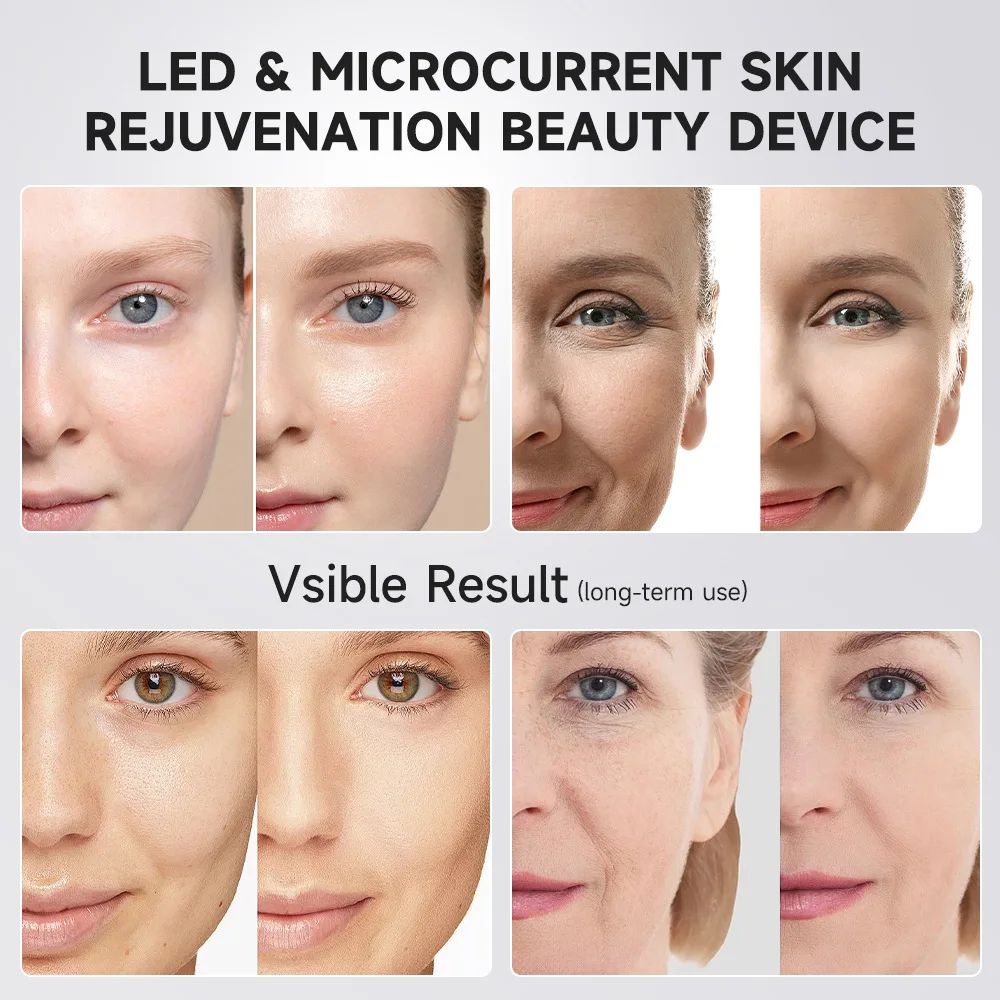 Booster Pro Led Facial Light Therapy 5 Colors Eye Beauty Wand Red Light Eye Massager for Skincare Rejuvenation Tool 3