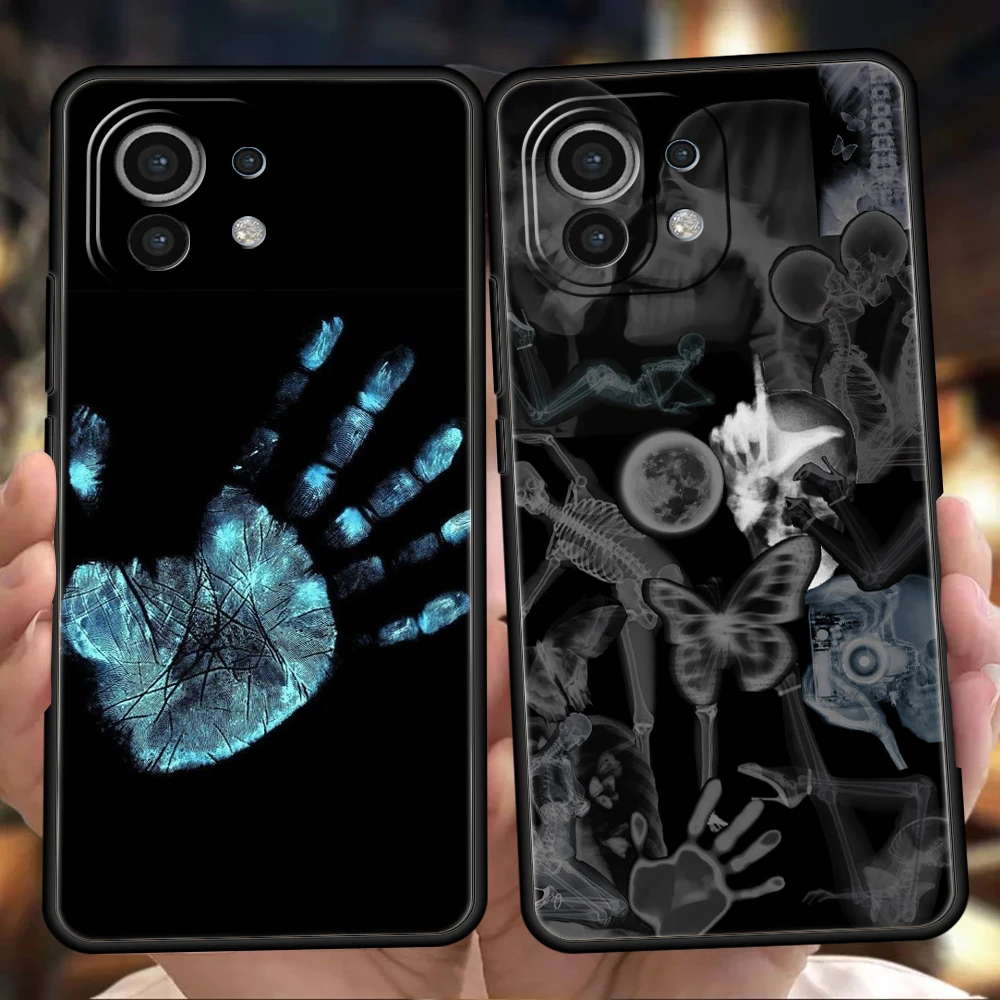 Autumn X-Ray Hand Bones Soft TPU Phone Case Cover