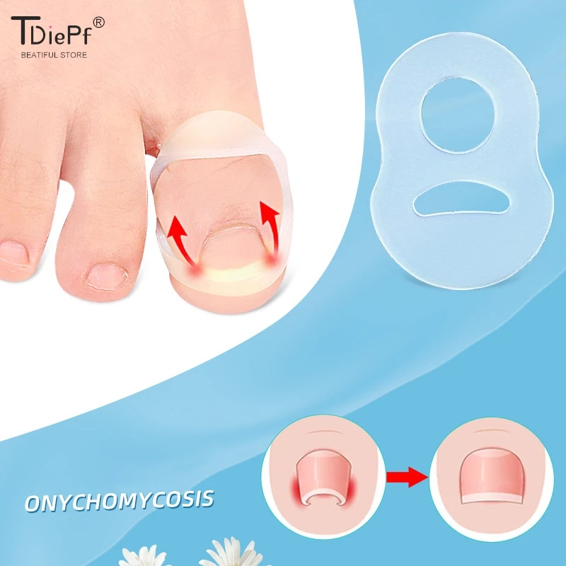 

1Pc Silicone Ingrown Toenail Correction Tool Invisible Ingrown Toe Nail Treatment Elastic Straightening Clip Brace Pedicure Tool