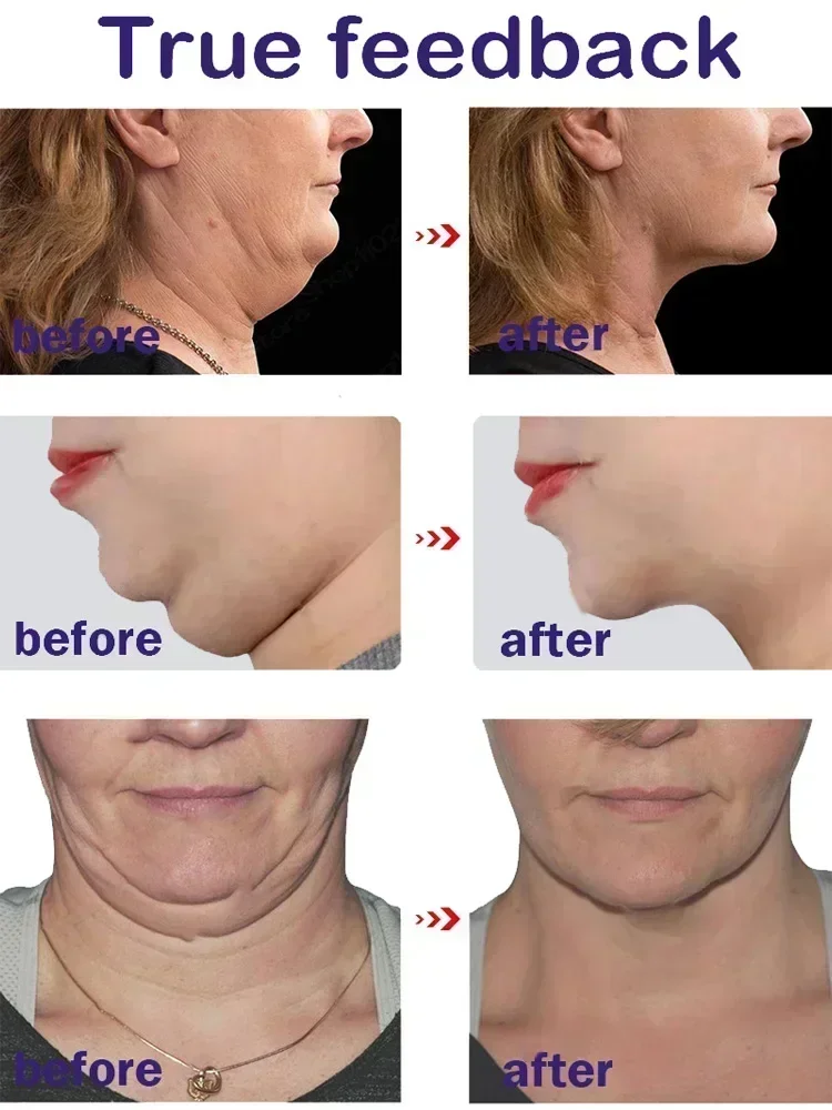 Effective V-Shape Face Slimming Lifting Facial Cream Lift Up V Double Chin Cheek Slimming Firming Anti Wrinkle Beauty Skin Care - Image 5