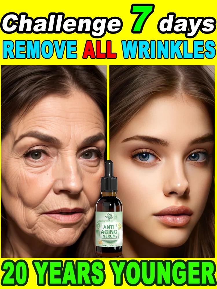 wrinkles disappeared