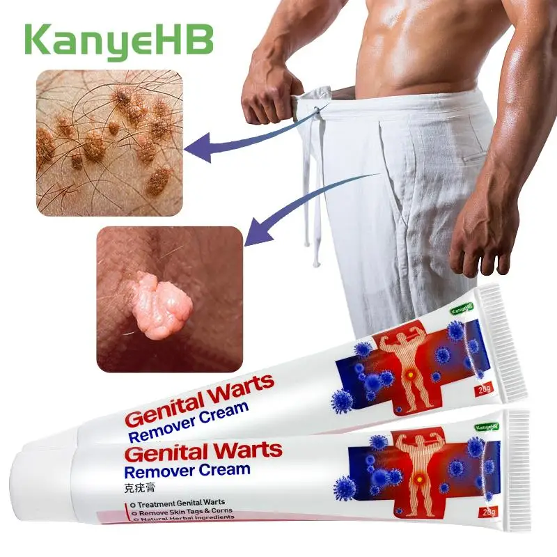 

2Pcs Skin Tag Remove Cream Herbal Extract Genitals Wart Treatment Foot Corn Plaster Papillomas Warts Antibacterial Ointment A664