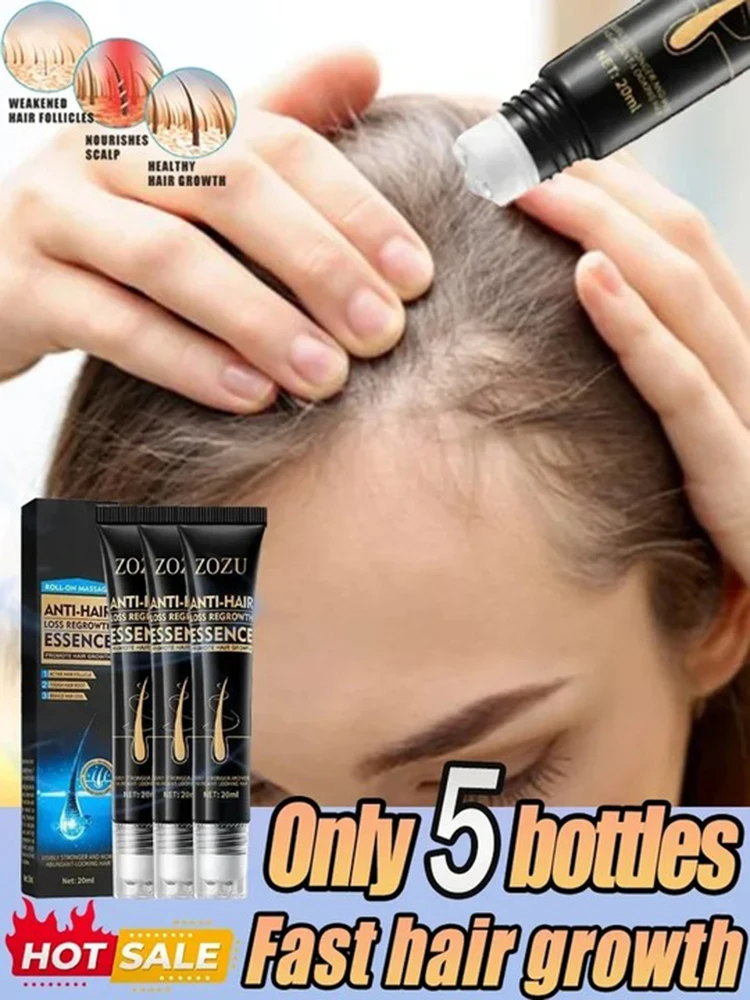 Fast Hair Growth Essence Effective Anti Hair Loss Serum Baldness Repair Hereditary Postpartum Seborrheic Loss oil Care hair growth serum hair care oil