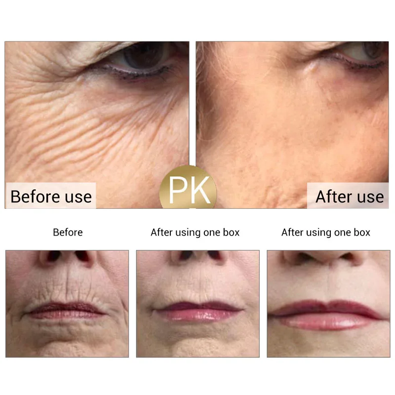 Facial Serum Facial Essence Blue Microneedle Shrink Pores Whitening Lifting Firm Fine Line Moisturise Melanin Remove Skin Care Product