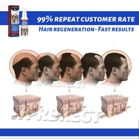 Produits les plus vendus3ème génération, spray multi-effets, maintient efficacement le cuir chevelu et empêche la casse 5