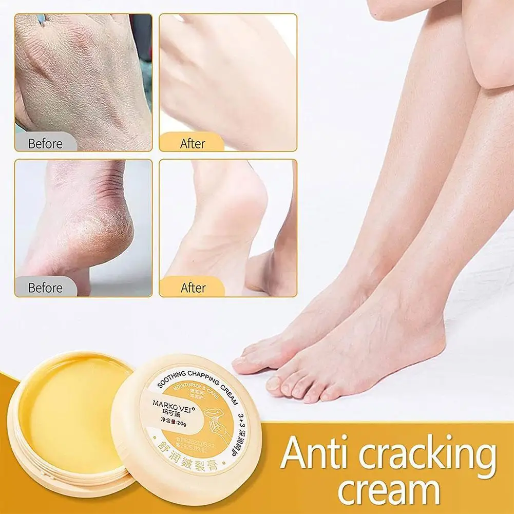 

NEW 20G Heel Balm For Dry Cracked Feet Cracked Skin Repair Cream Removal Dead Skin Hand Feet Smooth Moisturizing Care