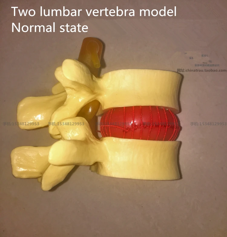 

medical Two lumbar vertebra model Normal state CMAM VERTEBRA12 Life-size Lumbar Vertebrae Models in 3 Stages of Degeneration